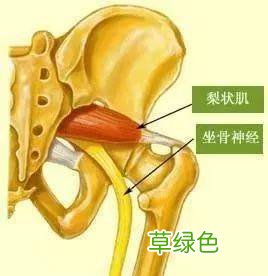 女性右腿后面筋疼是不是坐骨神经