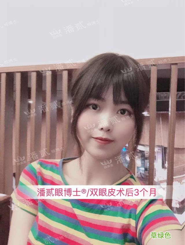 姑娘们20出头却眼睛显老，双眼皮手术上扬眼尾走起 怎么眼尾上扬
