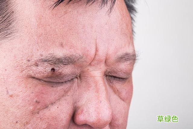出现4种面相，可能是疾病或癌的预兆，别以为是“福相” 掌相怎么看
