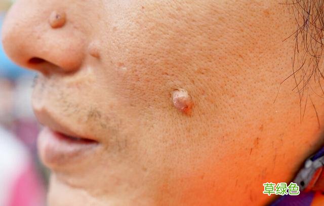 出现4种面相，可能是疾病或癌的预兆，别以为是“福相” 掌相怎么看