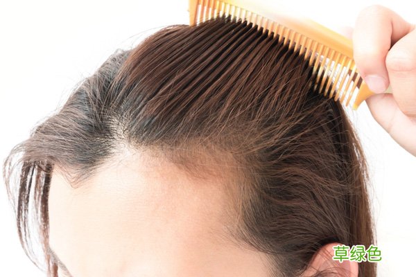 脱发可以烫头吗-心动的信号脱发