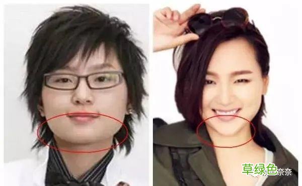 方脸短下巴，眼距宽怎么办？不动刀也能改善 短下巴怎么好看