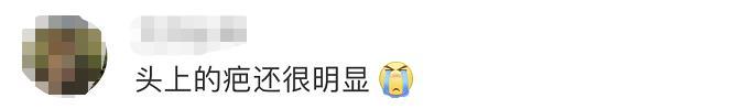 “英雄团长”祁发宝再次公开亮相，头上这道伤痕让人心疼...... 祁起名字