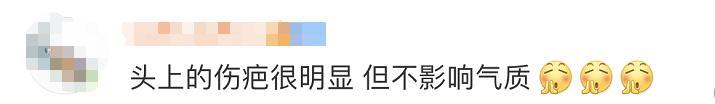 “英雄团长”祁发宝再次公开亮相，头上这道伤痕让人心疼...... 祁起名字