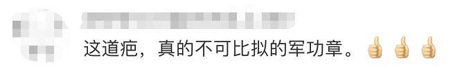 “英雄团长”祁发宝再次公开亮相，头上这道伤痕让人心疼...... 祁起名字