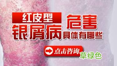 红皮型银屑病 红皮型银屑病