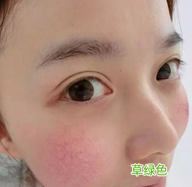 孩子过敏脸肿了怎么办 过敏脸肿了怎么办