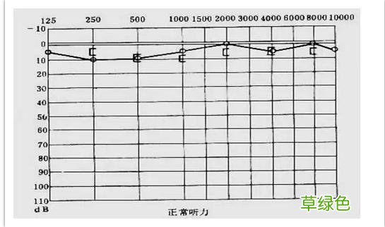 耳鸣耳聋的听力测试图怎么看？ 耳鸣怎么测试