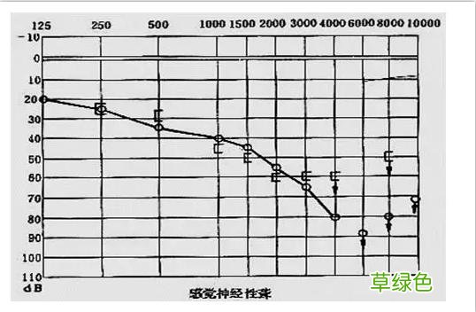 耳鸣耳聋的听力测试图怎么看？ 耳鸣怎么测试