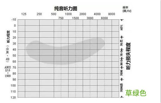 耳鸣耳聋的听力测试图怎么看？ 耳鸣怎么测试