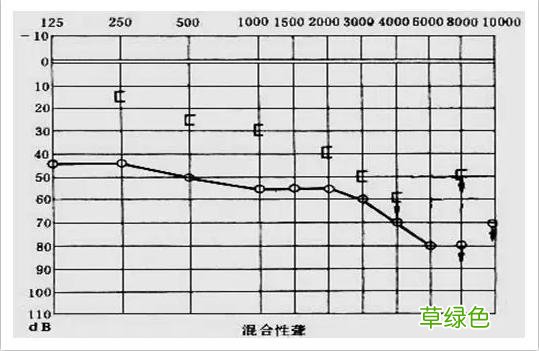 耳鸣耳聋的听力测试图怎么看？ 耳鸣怎么测试