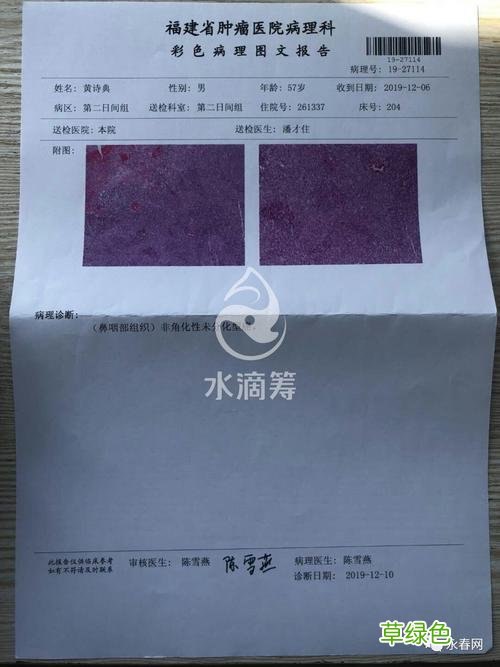 鼻咽癌怎么确诊 ct 鼻咽癌怎么确诊