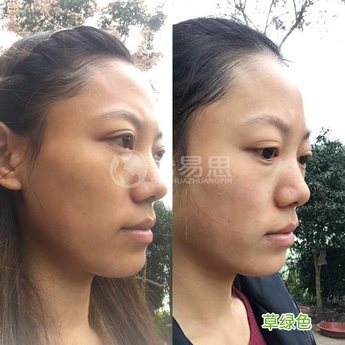 暗黄皮肤怎么美白 暗黄皮肤如何美白