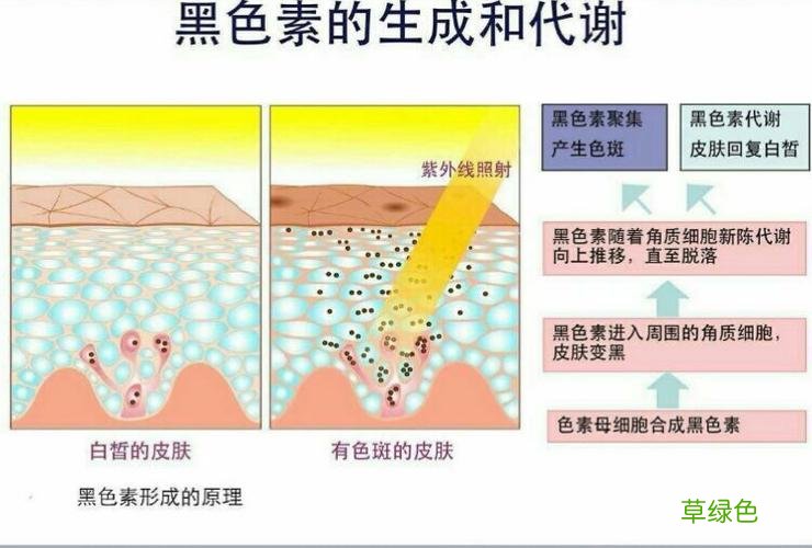 黄褐斑是怎么形成的 斑是怎么形成的