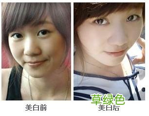 注射美白针有什么副作用吗 打美白针副作用