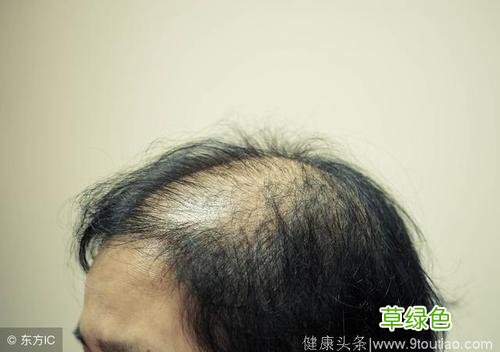 掉头发是缺什么营养 掉头发是缺什么