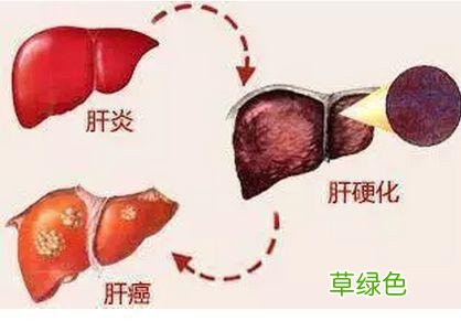 丙肝治疗方法最好是怎么治疗 丙肝治疗方法