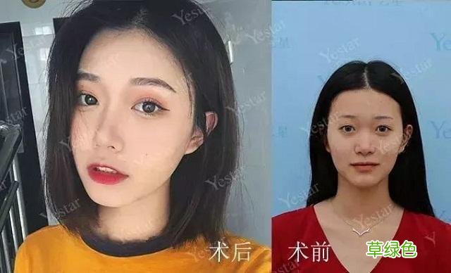 宝宝鼻子很塌怎么办 鼻子很塌怎么办