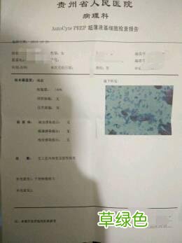 宫颈纳氏囊肿图片大全 彩超 宫颈纳氏囊肿图片