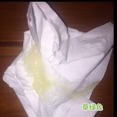 怀孕初期分泌物一坨坨 怀孕初期分泌物