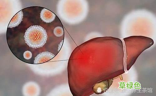 中医肝腹水的治疗方法 肝腹水的治疗方法