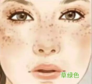 蝴蝶斑怎么去掉啊 蝴蝶斑怎么去