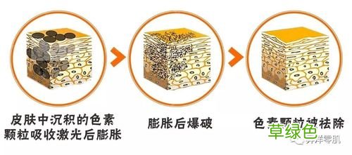 黄褐斑的形成原因和治疗方法 黄褐斑的形成原因