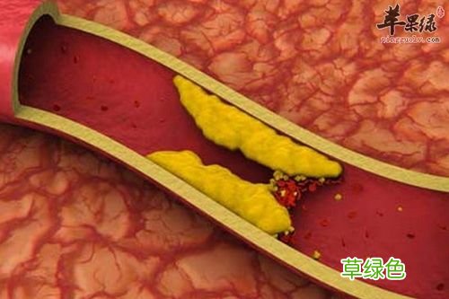 胆固醇高的原因和禁忌 胆固醇高的原因