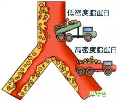 胆固醇高的原因和禁忌 胆固醇高的原因