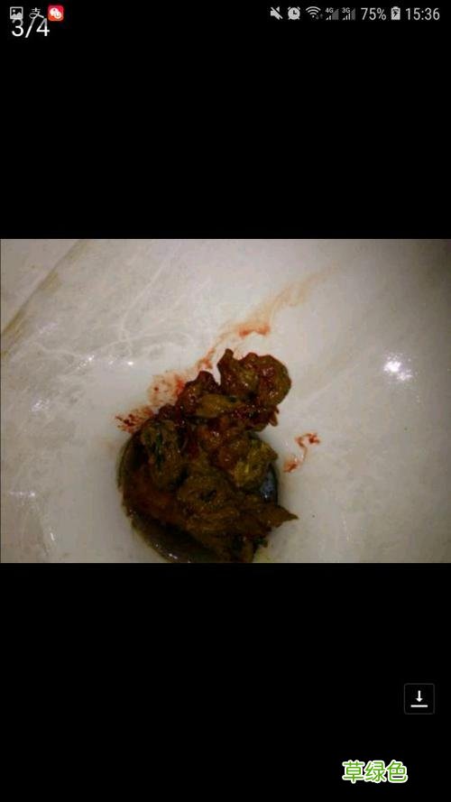 大便变黑色是什么原因怎么办 大便黑色怎么办