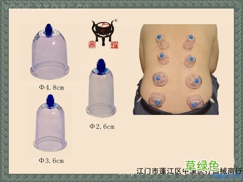 拔火罐有副作用没有 拔火罐的副作用