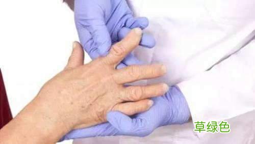 风湿病哪里治疗的最好 风湿病能治好吗