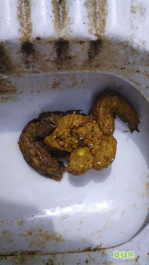 大便干燥吃什么药效果最好 大便干燥吃什么