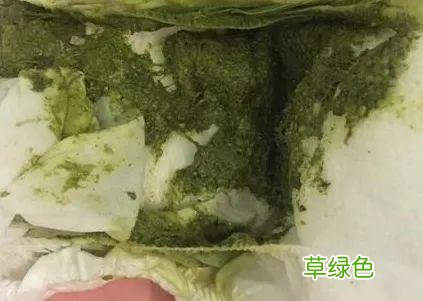 宝宝大便发绿有奶瓣怎么回事 宝宝大便发绿