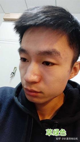 鼻头大怎么才能小下来 鼻头大怎么办