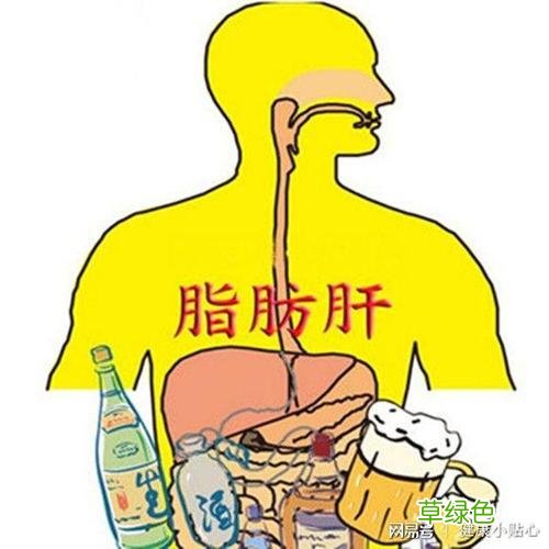 常见的富贵病有哪些 富贵病有哪些