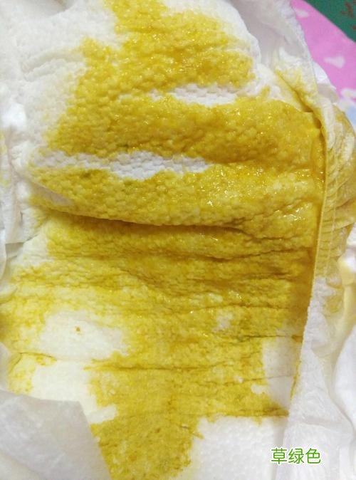 婴儿拉稀便怎么回事 宝宝拉稀怎么回事