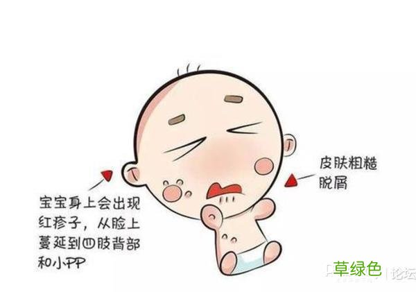 孩子有湿疹怎么办 宝宝有湿疹怎么办