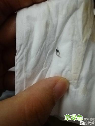 产完恶露什么时候干净 恶露什么时候干净