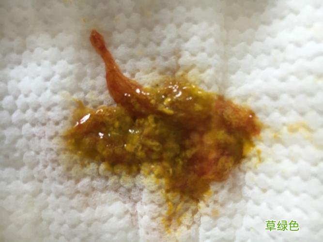 宝宝憋屎不拉怎么办 宝宝不拉屎怎么办