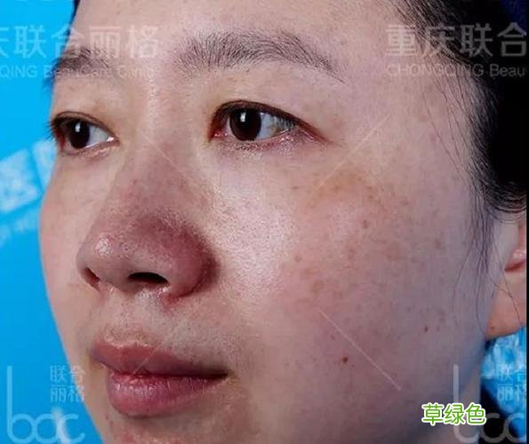 肤色不匀怎么办 肤色不匀怎么办
