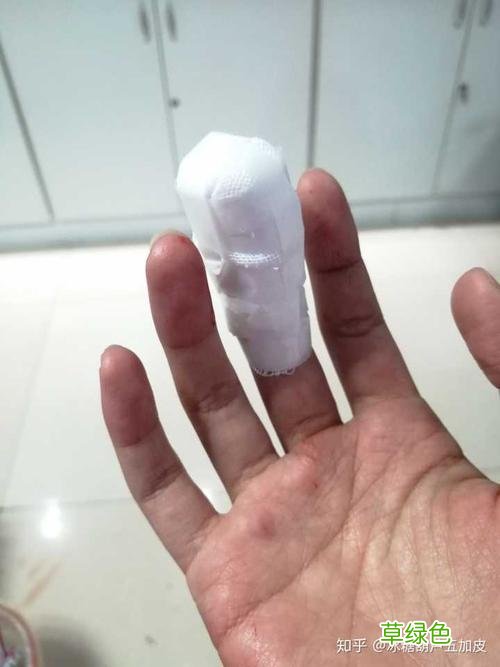 皮试破伤风针多少钱 破伤风针多少钱