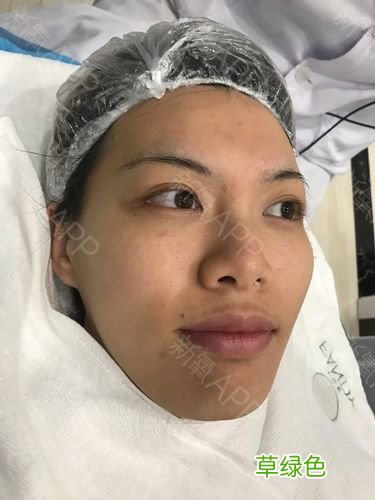 面部肤色不均匀什么原因 面部肤色不均