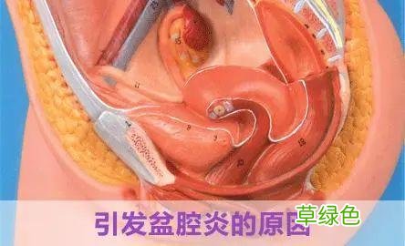盆腔炎治疗方法大全 盆腔炎治疗方法