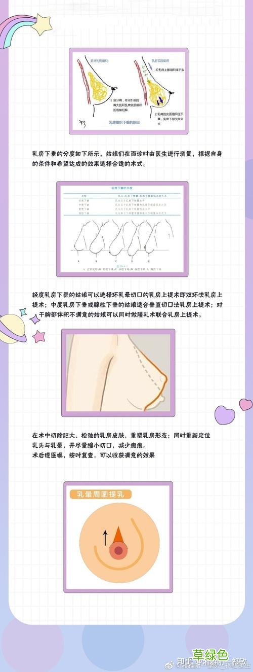 胸部下垂怎么办软绵绵的怎么办 乳房下垂怎么办