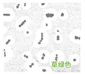 溶血性链球菌感染是什么原因引起的 溶血性链球菌
