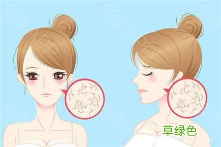 秋季皮肤干燥的原因 秋季皮肤干燥