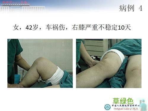 韧带拉伤最好的恢复方法是什么 韧带拉伤怎么办