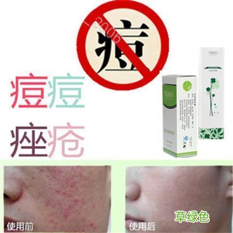 痤疮杆菌引起的痘痘怎么治疗 如何祛除痤疮