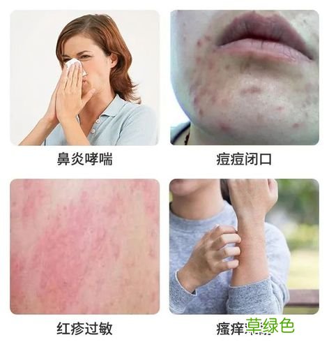 螨虫过敏症状 螨虫过敏症状